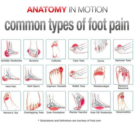 anime feet pirn|5 Common Causes of Foot Pain During Running .